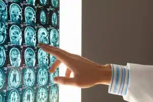 brain injury attorney orlando florida