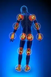 Pain & Suffering Damages in Personal Injury Lawsuits