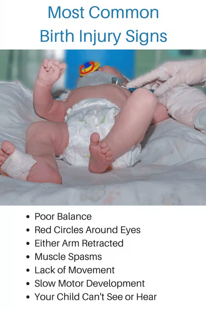 Birth Injury Signs