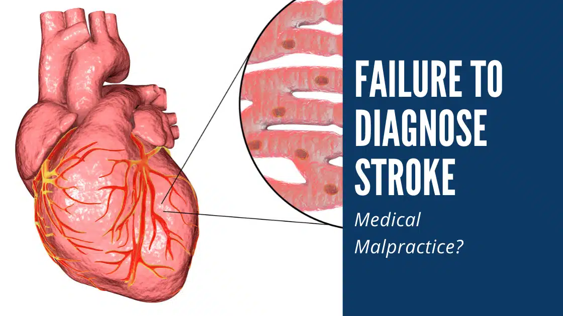 failure to diagnose stroke med mal orlando florida